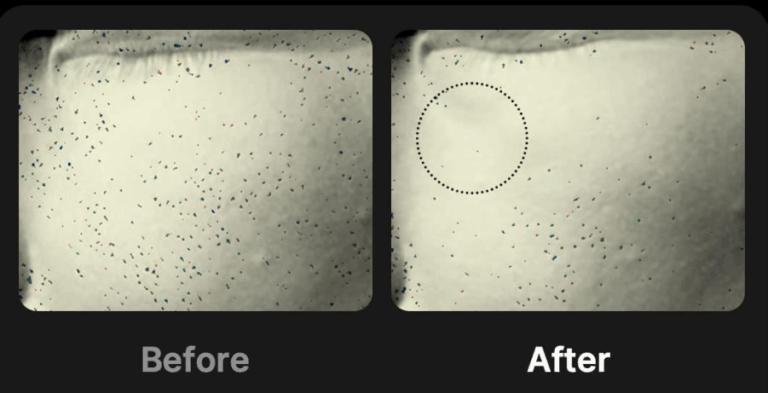 Máy đẩy tinh chất Medicube